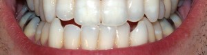 Teeth