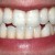Teeth