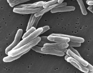 Scanning Electron Microscope image of Mycobacterium Tuberculosis