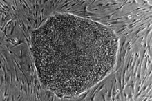 Human_embryonic_stem_cell_colony_phase
