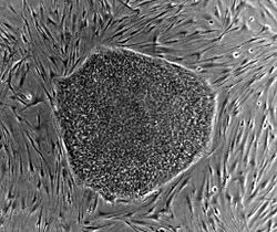 Human_embryonic_stem_cell_colony_phase