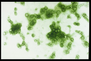 dengue flavivirus