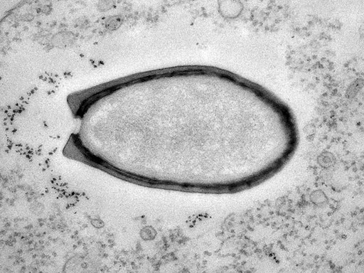 Microscope image of pandoravirus. Credit: Chantal Abergel and Jean-Michel Claverie